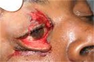 cut eyeball